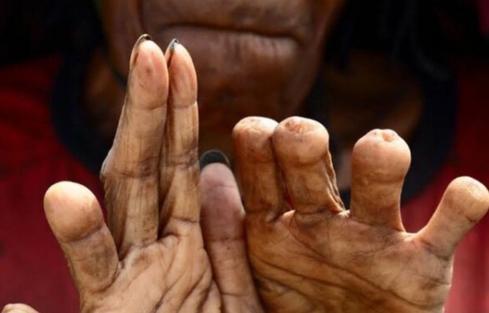 Niki Paleg, Potong Jari Ala Suku Dani